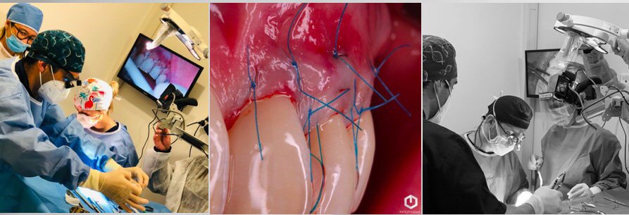 Formation chirurgie plastique parodontale