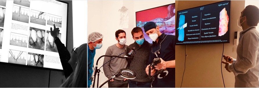 Formation chirurgie plastique parodontale