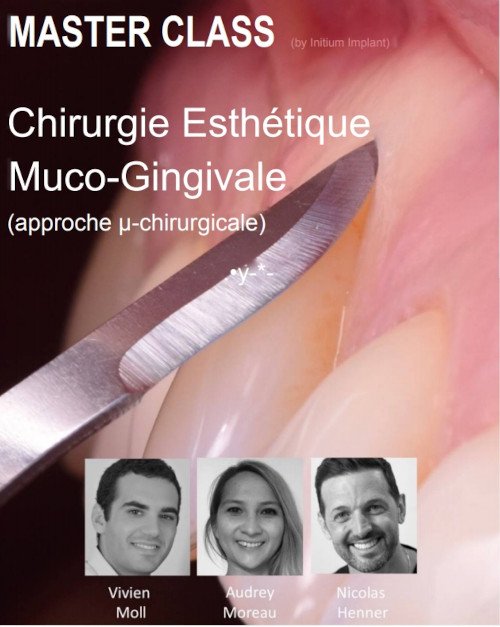 Formation chirurgie plastique parodontale
