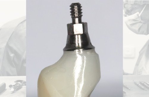 formation protheses sur implants