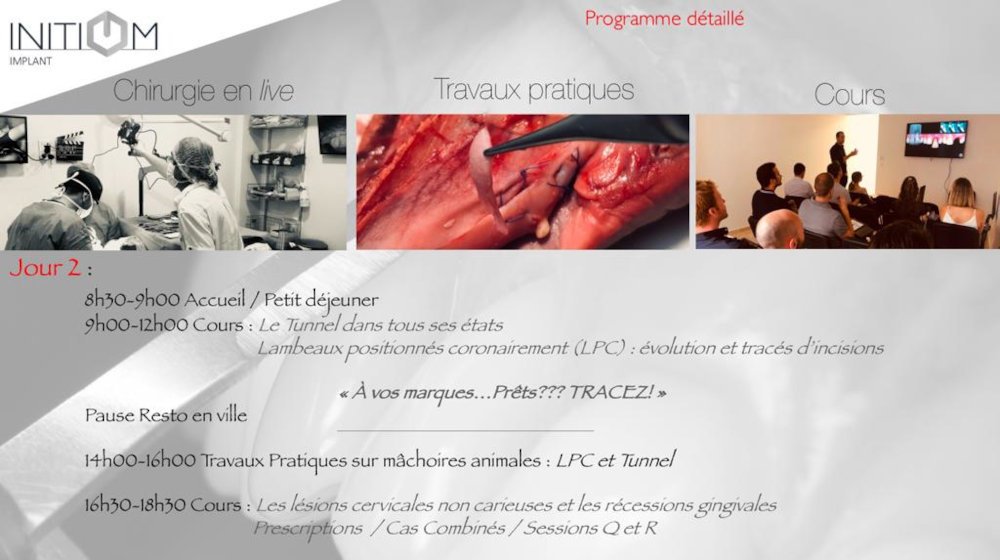 formations muco gingivale Gard